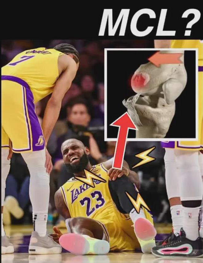 NBA 季后赛湖人出局，阵容调整待解，詹姆斯伤病成焦点