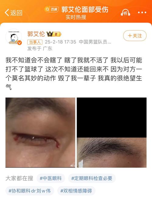 郭艾伦眼睛受伤细节曝光：队友不必要动作导致缝针一个半小时