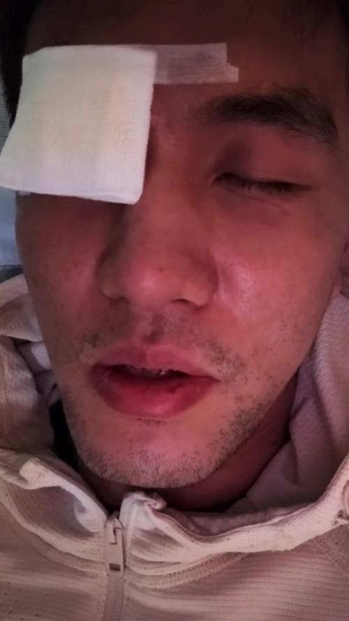 郭艾伦受伤专访：控诉对方球员恶意犯规，眼睛被捅瞬间绝望